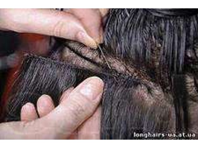 Для чего вшивают волос
