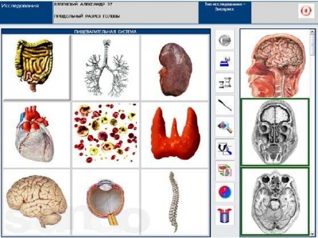 компьютерная диагностика всего организма в городе Бердск, фото 1, Новосибирская область