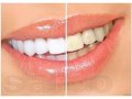 Отбеливающие полоски для зубов Crest Whitestrips в городе Хабаровск, фото 1, Хабаровский край